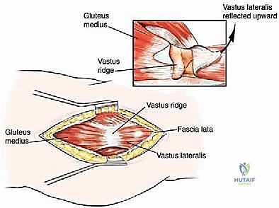 التصوير المقطعي ثلاثي الأبعاد