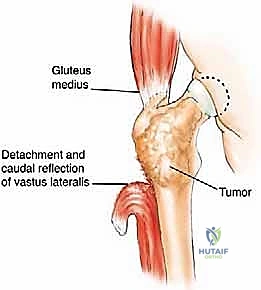 تطبيق نظام مايرلز في التقييم