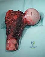 الدكتور محمد هطيف في غرفة العمليات