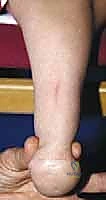 Clinical Image