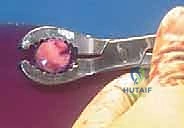 الوصول الجراحي الدقيق لمفصل الركبة