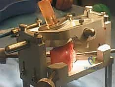 تشخيص إصابات الغضروف باستخدام الرنين المغناطيسي المتقدم