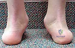 تجهيز المريض في غرفة العمليات المجهزة بأحدث التقنيات