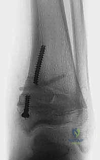 نقاش الخطة الجراحية مع المريض وأسرته قبل اتخاذ القرار