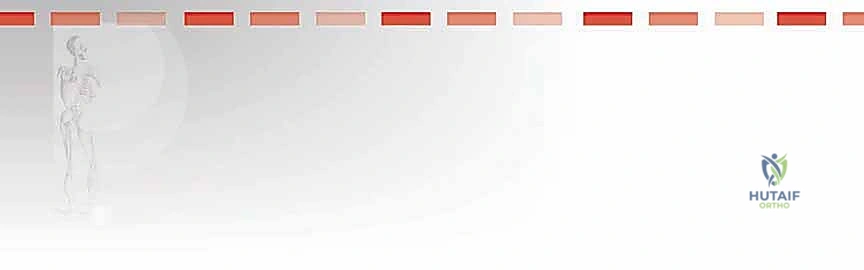 صورة توضيحية لـ خلع الكوع الكسري المعقد (الثالوث الرهيب): دليل شامل للعلاج والتعافي مع الأستاذ الدكتور محمد هطيف