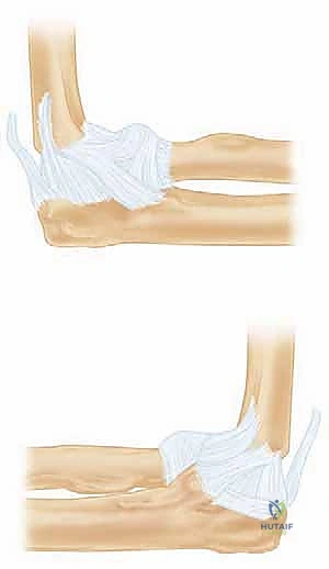 صورة توضيحية للتشريح الدقيق لمفصل الكوع والأربطة المعقدة