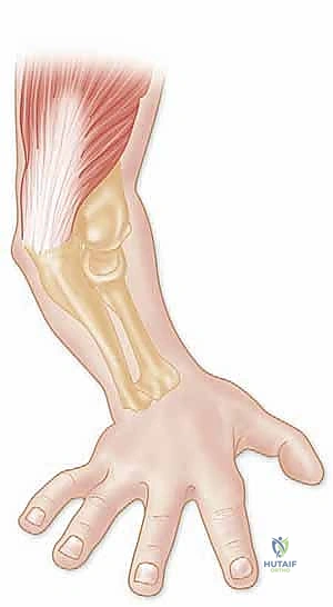 التخطيط الجراحي وفتح المفصل
