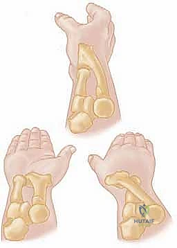 Intraoperative Surgical Step