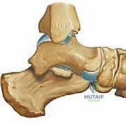 الشق الجراحي والوصول الآمن إلى العظم الإسفيني الإنسي