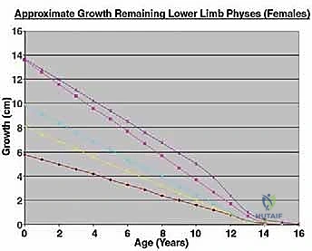 تشريح عظام الأطفال وصفائح النمو
