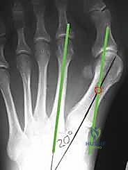 وصف طبي دقيق للمريض يوضح التخطيط الجراحي