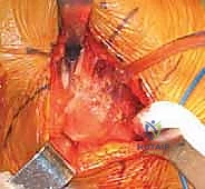 مقارنة خيارات العلاج