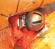 الأستاذ الدكتور محمد هطيف