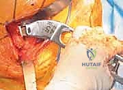 تحضير المريض قبل الجراحة