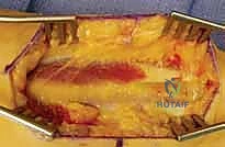 العودة للأنشطة الطبيعية