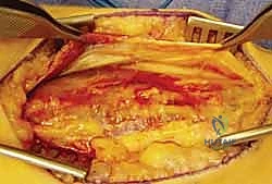 أحدث التقنيات في جراحة العظام