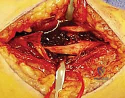 التخدير والتعقيم