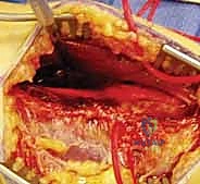 إعادة العظام لوضعها التشريحي