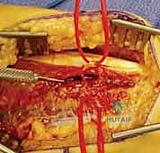 الميكانيكا الحيوية للساعد