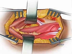 عظمتي الكعبرة والزند