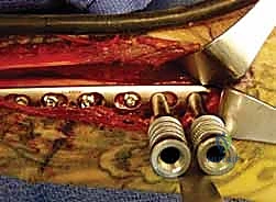 التشخيص بالأشعة السينية