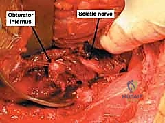 التأكد من استقرار المفصل بعد التثبيت