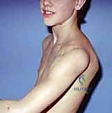 Arthroscopic Posterior Shoulder Stabilization: An Intraoperative Masterclass