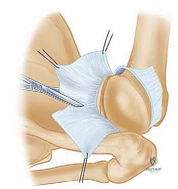 الفحص السريري الدقيق لمفصل الكتف مع د. هطيف