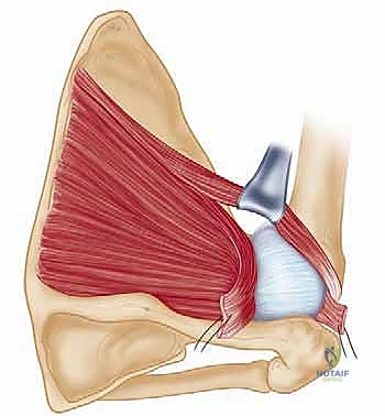 جلسات العلاج الطبيعي والتأهيل للكتف