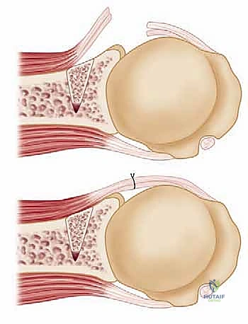 تجهيز المريض والتخدير في غرفة العمليات