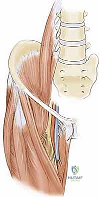 الأشعة السينية لتقييم مفصل الورك