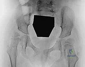 الأستاذ الدكتور محمد هطيف أثناء الجراحة