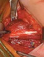 صورة توضيحية لـ تشنجات الورك لدى الأطفال: دليل شامل لإطالة العضلة الحرقفية القطنية والعضلات المقربة مع الأستاذ الدكتور محمد هطيف