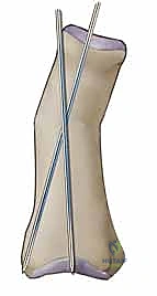 Intraoperative Surgical Step