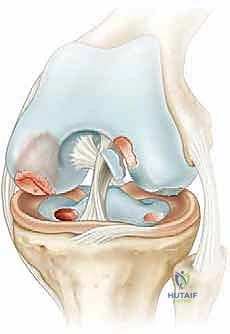 وصف طبي دقيق للتشريح المفصلي