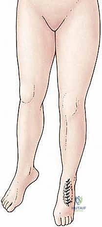 وصف طبي دقيق للمريض