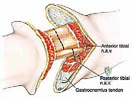 العناية بالجرح والتعافي الأولي بعد الجراحة