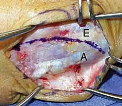 آلية الإصابة الرضية