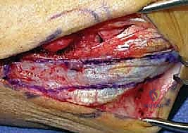 فحص الأعراض السريرية