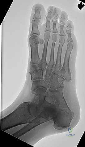 الأشعة السينية قبل الجراحة