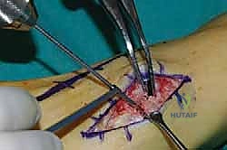 توضيح تشريحي لمفاصل القدم