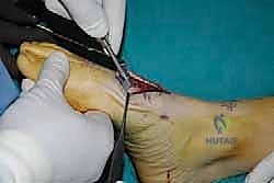 قياس عمق المسمار المطلوب