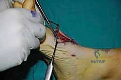 استخدام أدوات القياس الدقيقة