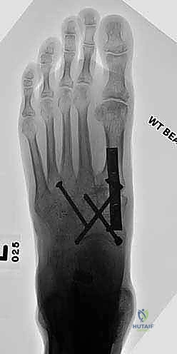 تأكيد المواقع عبر جهاز الأشعة المرئي C-Arm