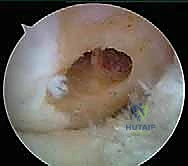 تجهيز الرقعة الوترية