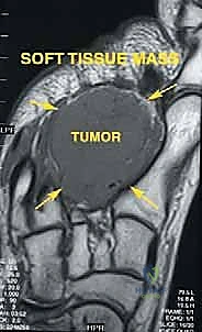 Intraoperative Surgical Step