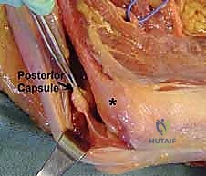 توضيح الأعصاب والأوعية الدموية في منطقة المرفق