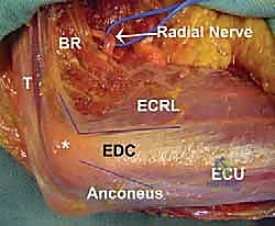 أسباب تيبس المرفق والتغيرات العظمية