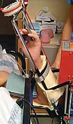 صورة توضيحية لـ تحرير تيبس المرفق بتقنية العمود الجانبي: استعادة حركة ذراعك مع الأستاذ الدكتور محمد هطيف