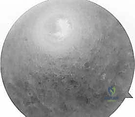 صورة توضيحية لـ إعادة بناء الرباط الصليبي الأمامي التصحيحية: حل شامل لحالات الفشل الجراحي السابق في صنعاء مع الأستاذ الدكتور محمد هطيف